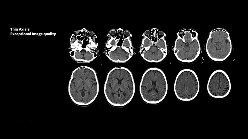 ge-revolution-aspire-routine-brain-image4
